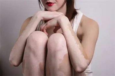 ʲôǷͰ
